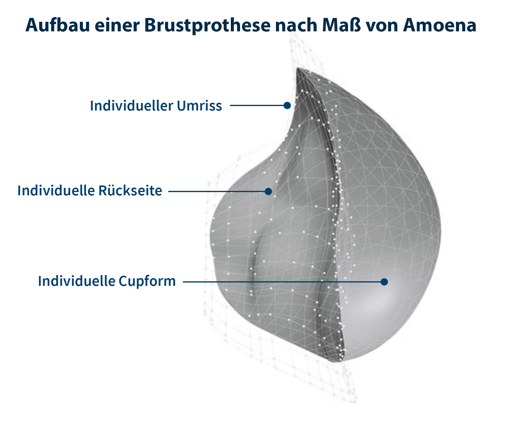 Aufbau einer Brustprothese nach Maß